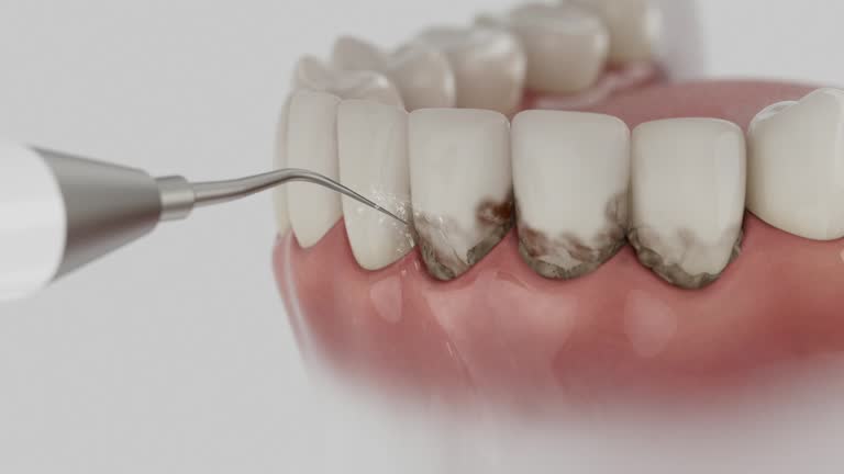 Reliable Teeth Whitening contractor in Mammoth Spring, AR by Smile Center Dentistry